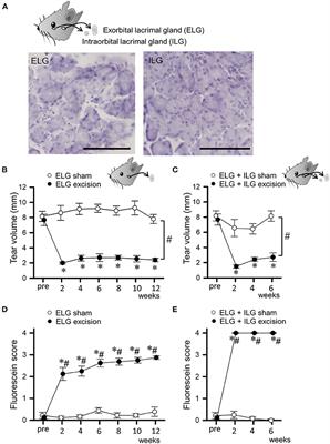 Voluntary wheel-running activities ameliorate depressive-like behaviors in mouse dry eye models